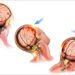 Brain Bleeding After a Head Injury: Symptoms You Should Never Ignore