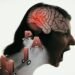 How Stress Affects Your Brain: Understanding the Impact of Chronic Stress